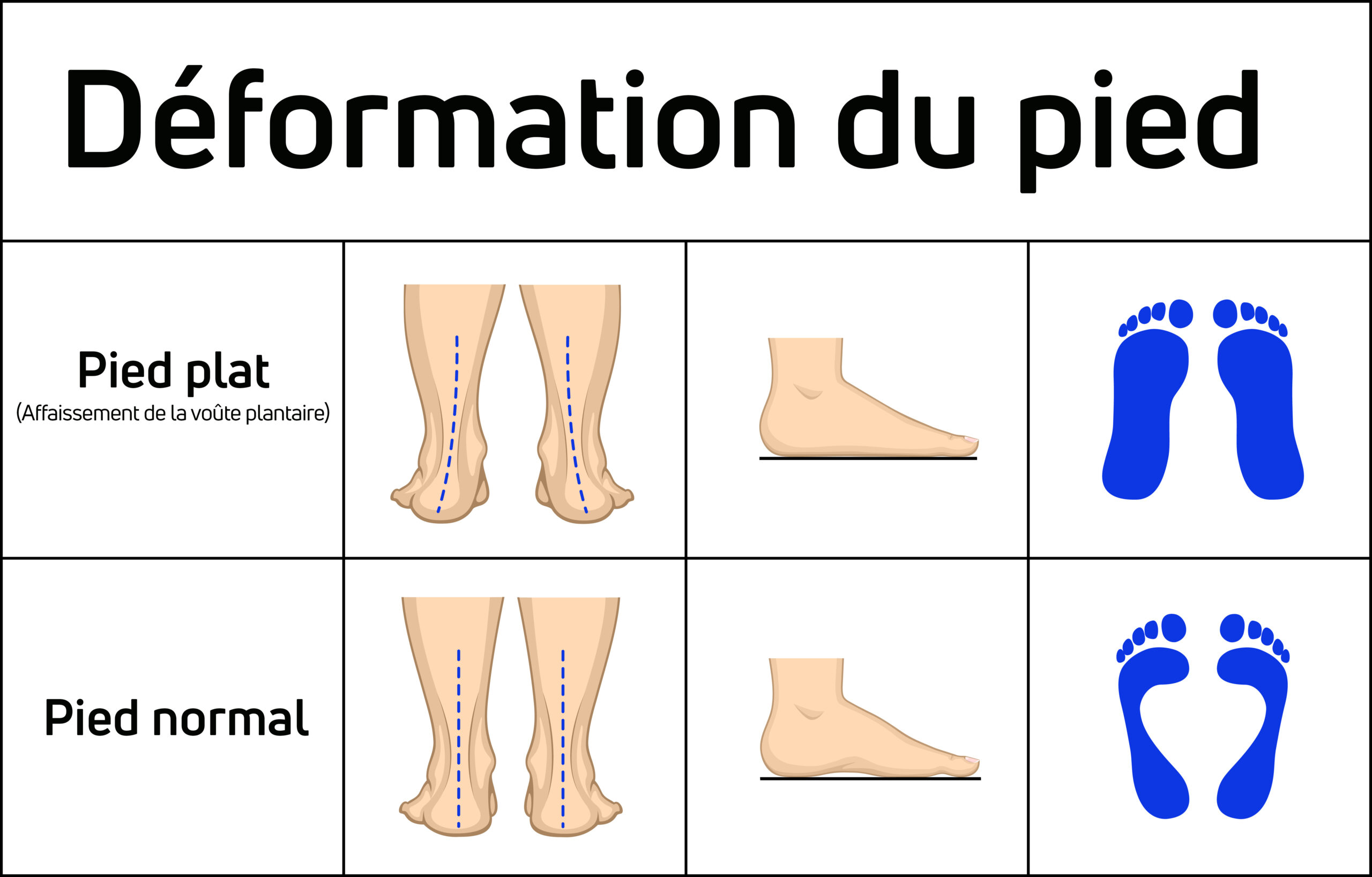 What is cream pied