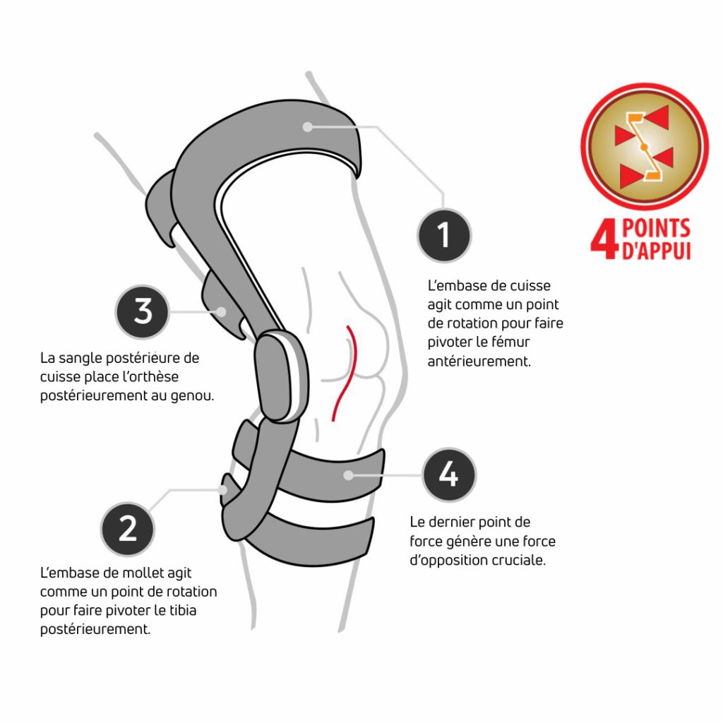 système 4 points d'appui DonJoy