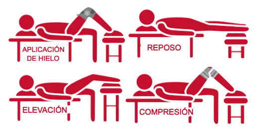 Tratamientos complementarios en desgarro muscular